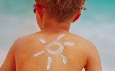 So schützen Sie sich natürlich vor der Sonne